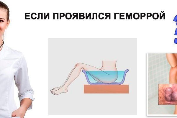 Как зайти на кракен через айфон